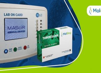 Innovation. MAScIR lance le 1er test de diagnostic de la tuberculose 100% marocain