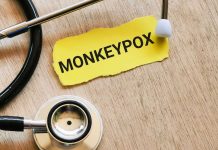 Monkeypox : le Maroc met en place un plan national de surveillance et de riposte, les détails