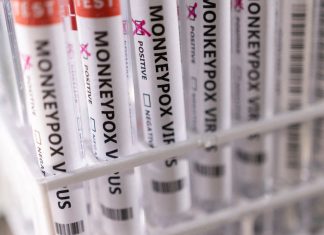 Le Maroc enregistre son 1er cas positif de la variole du singe