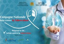 Campagne nationale de prévention de la tuberculose : Un pas vers l’éradication de la maladie Campagne nationale de prévention de la tuberculose : Un pas vers l'éradication de la maladie