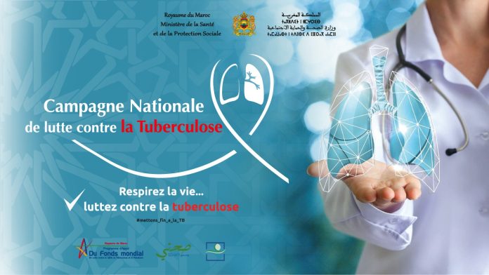 Campagne nationale de prévention de la tuberculose : Un pas vers l'éradication de la maladie