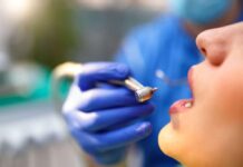 Dentistes non agréés : un danger pour la santé, alerte l’Ordre national Dentistes non agréés : un danger pour la santé, alerte l’Ordre national