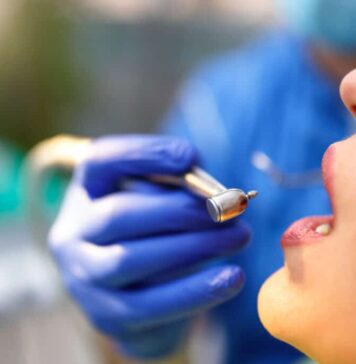 Dentistes non agréés : un danger pour la santé, alerte l’Ordre national Dentistes non agréés : un danger pour la santé, alerte l’Ordre national