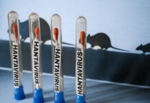 Hantavirus : un vol sanitaire dérouté après le refus du Maroc Hantavirus : un vol sanitaire dérouté après le refus du Maroc