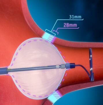 Le Maroc concerné par le rappel de 262.686 cathéters Boston Scientific Le Maroc concerné par le rappel de 262.686 cathéters Boston Scientific